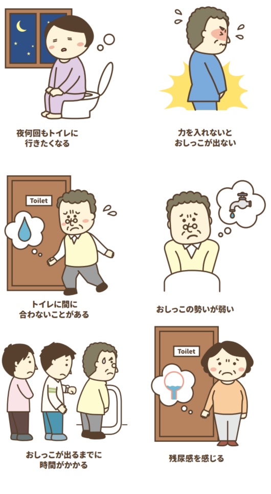 前立腺肥大症の症状